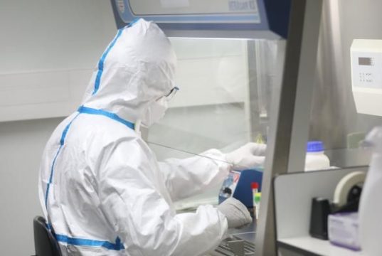 « Probablement le traitement le plus simple pour traiter le coronavirus » : les spécialistes s’enthousiasment pour la chloroquine, déjà utilisée contre le paludisme