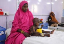 Nord du Nigeria : Médecins Sans Frontières (MSF) mobilisée contre le kwashiorkor, une forme grave de la malnutrition